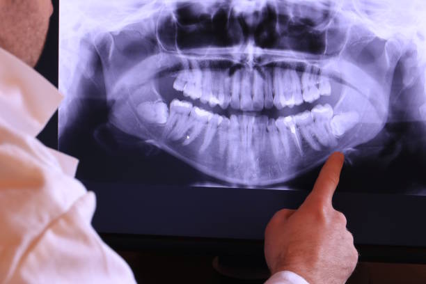 Best Emergency Root Canal Treatment in Centerburg, OH