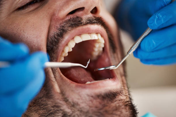 Best Emergency Dentist for Special Needs Patients in Centerburg, OH