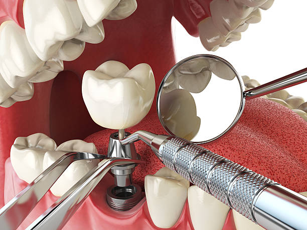 Best Mobile Emergency Dentist in Centerburg, OH